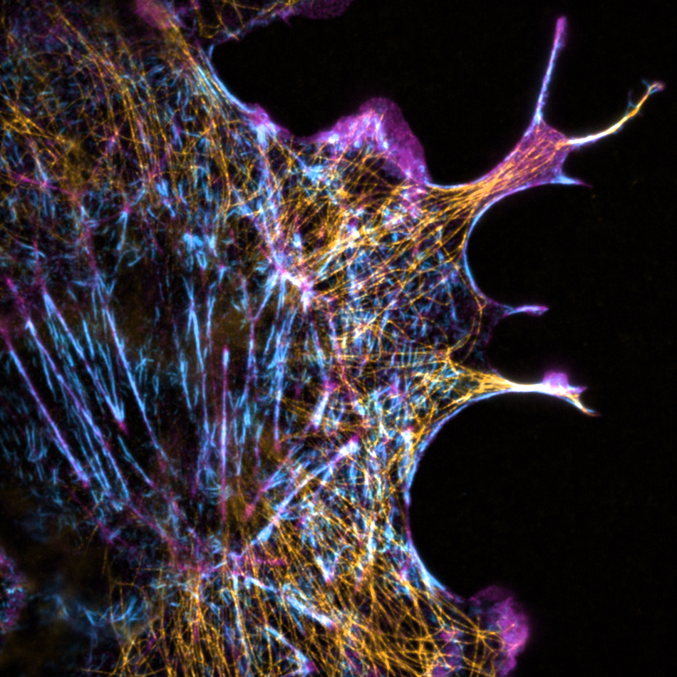 Image description: COS7 SEPT7 a-Tubulin F-actin