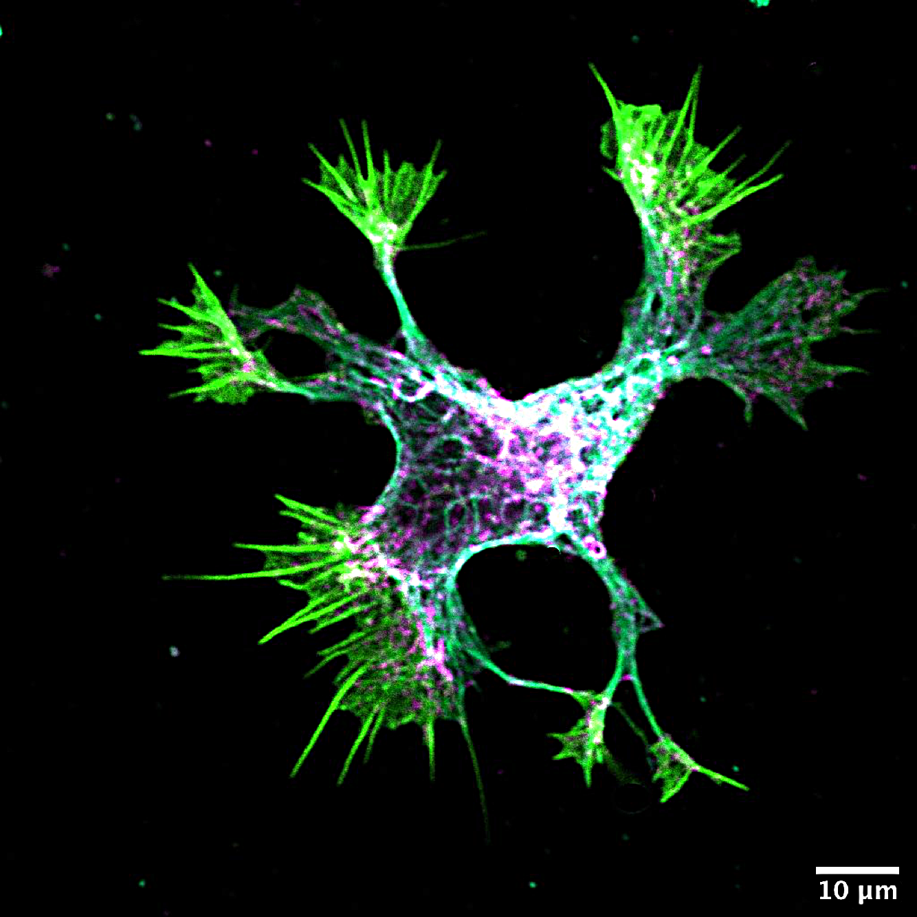 Image description: Toddler Neuron